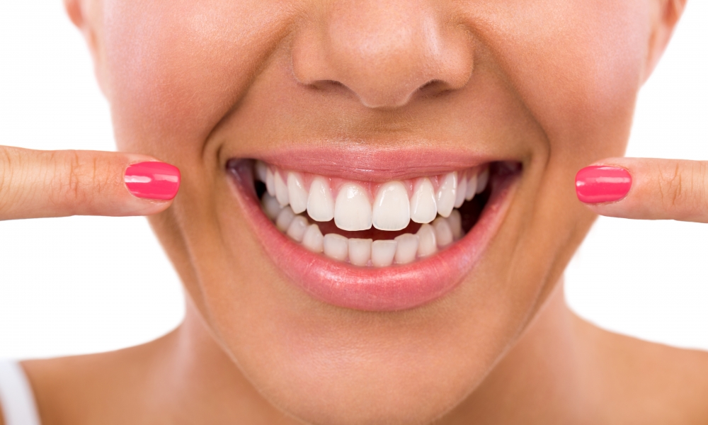 Smile Design