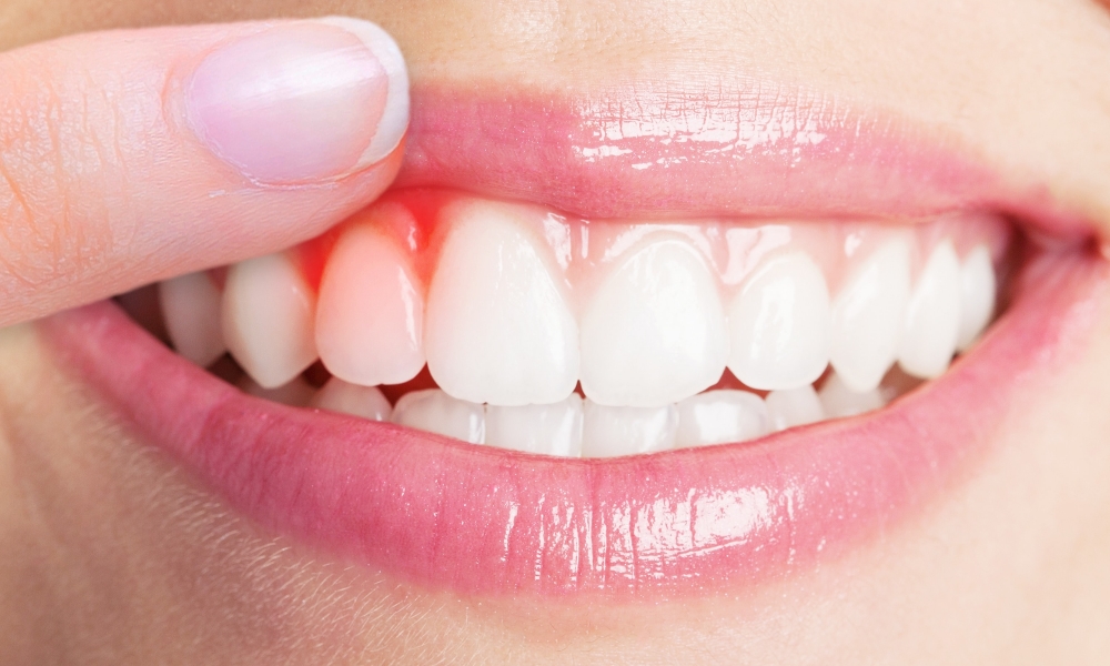 Gum Treatment (Periodontology)