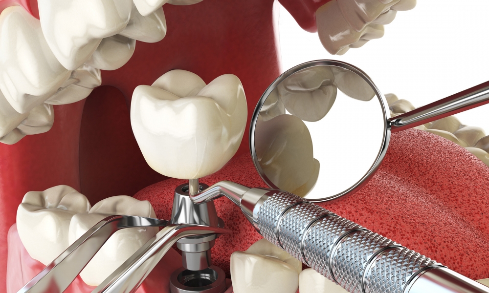 Prosthetic Dentistry