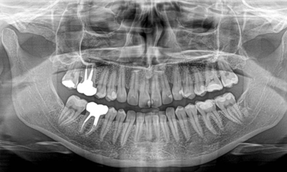 Oral Diagnosis And Radiology